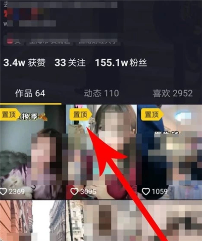 抖音如何頂置視頻