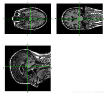 python 讀取.nii格式圖像實例