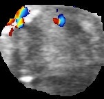 python opencv實現目標區域裁剪功能