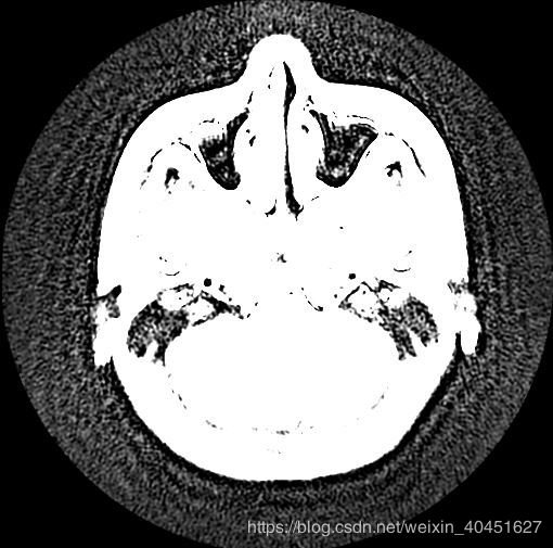 使用Python對Dicom文件進行讀取與寫入的實現