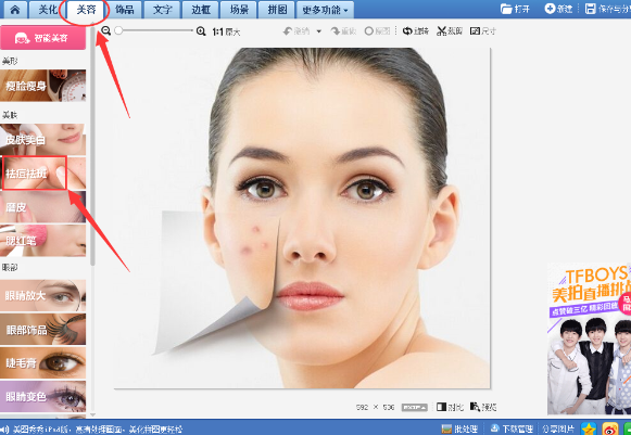 美圖秀秀怎么去除痘痘疤痕？美圖秀秀去除痘痘疤痕圖文教程