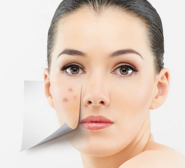 美圖秀秀怎么去除痘痘疤痕？美圖秀秀去除痘痘疤痕圖文教程