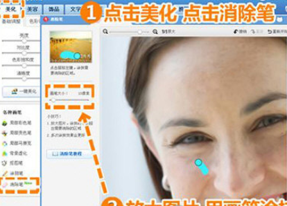 美圖秀秀怎么為人像消除皺紋？美圖秀秀為人像消除皺紋步驟詳解