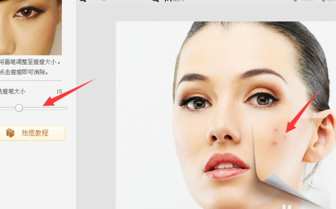 美圖秀秀怎么去除痘痘？