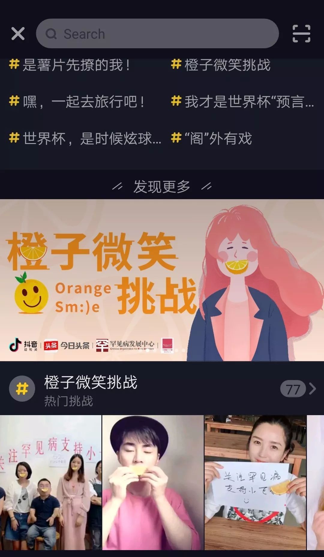 【抖音小飛俠是什么意思】小飛俠是什么病？橙子微笑挑戰如何參加