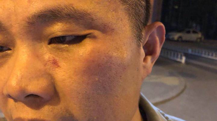 滴滴司機(jī)打投資人是怎么回事