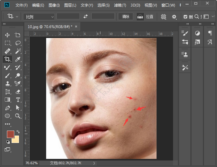 ps怎么把痘痘p沒