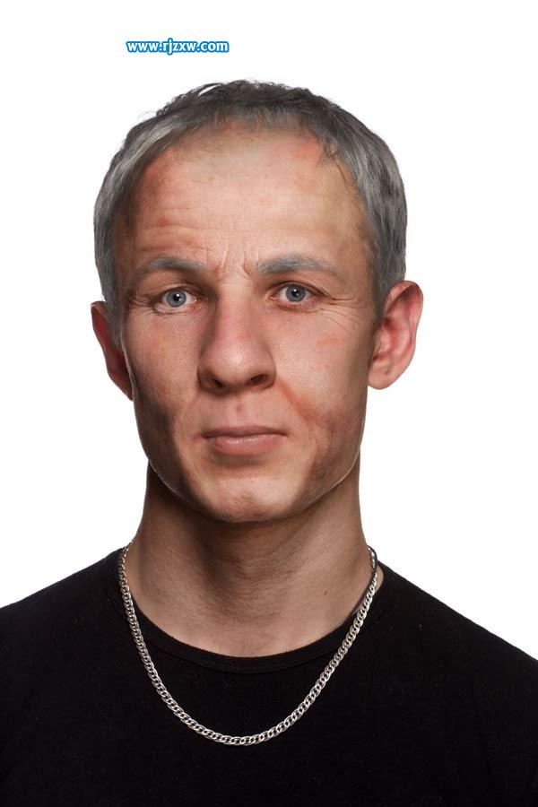 20歲男子一夜變成老頭