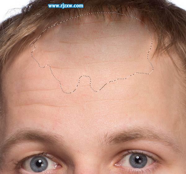 20歲男子一夜變成老頭